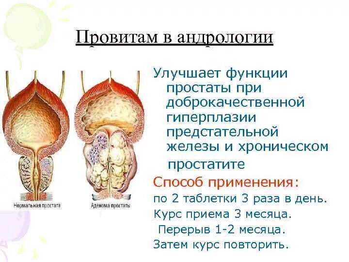 Предстательная железа функции у мужчин. Гиперплазия предстательной железы. ДГПЖ предстательной железы что это такое. Простата гиперплазия предстательной железы. Предстательная железа при доброкачественной гиперплазии.