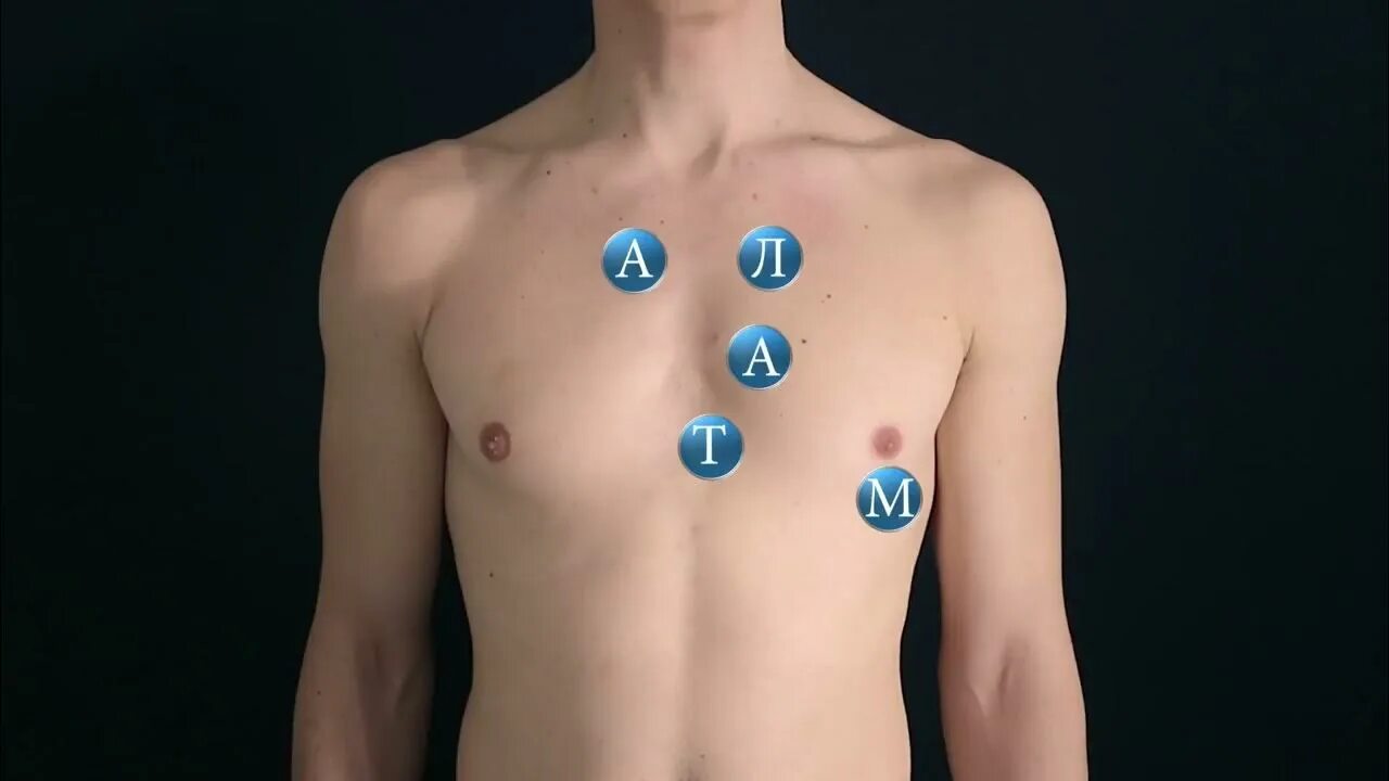 Аускультация сердца. Точки аускультации. Аускультативные точки сердца. Точки выслушивания сердца.