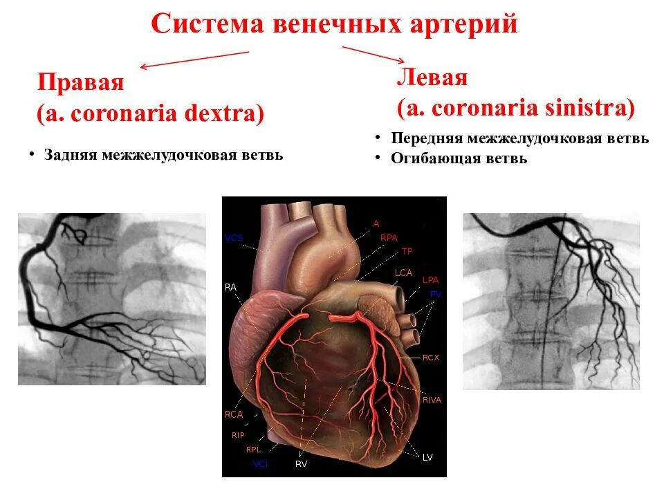 Коронарные венечные сосуды. Коронарография схема сосудов. Огибающая правой венечной артерии. Коронарные и венечные артерии сердца.