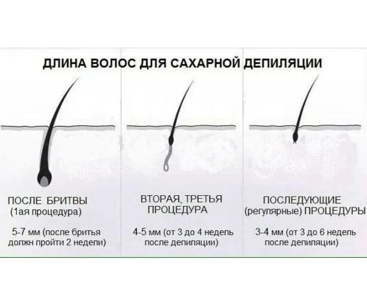 Депиляция сколько см. Депиляция ног до и после. Эпиляция бикини глубокое. Волосы 5 мм для шугаринга. Ждина волос для эпиляция.