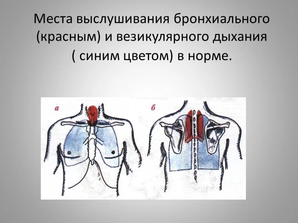 Аускультация везикулярного дыхания. Места выслушивания бронхиального дыхания в норме. Места выслушивания везикулярного дыхания в норме. Бронхиальное дыхание пропедевтика. Бронхиальное дыхание аускультация.