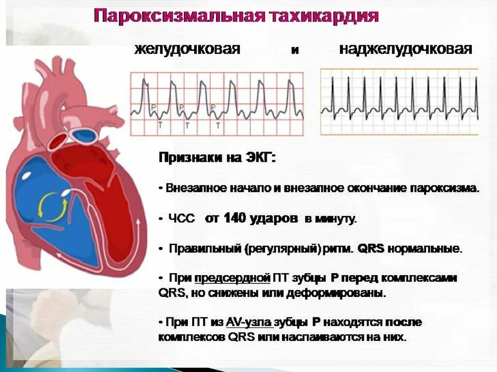 Сильное сердцебиение температура