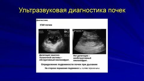 Диагноз узи почек