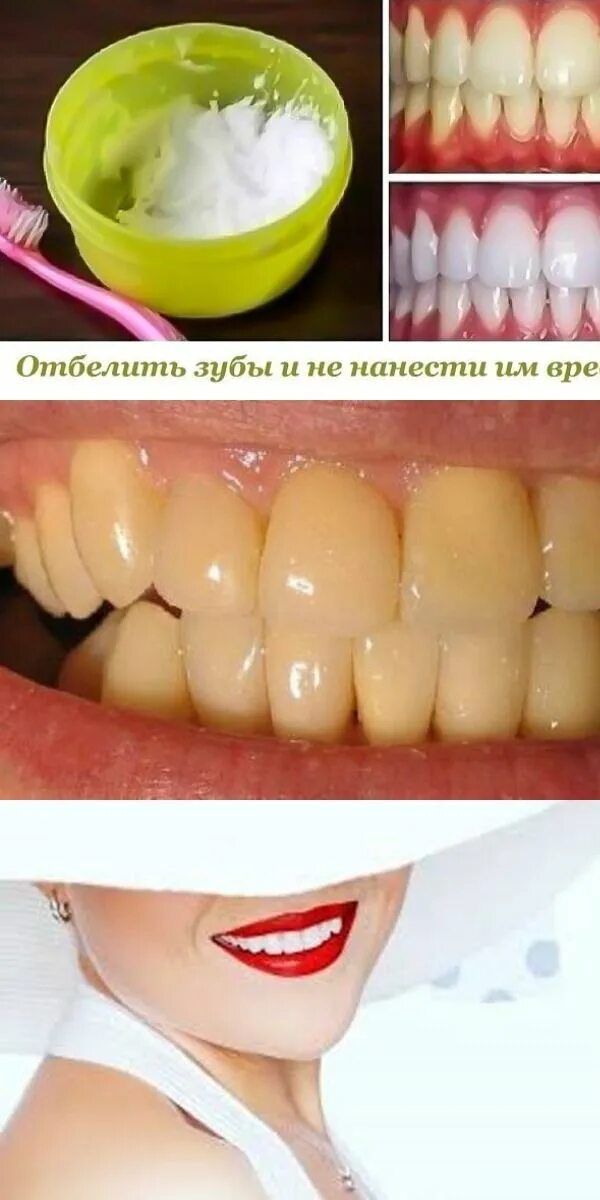 Как отбелить зубы рецепт. Как отбелить зубы рецепт