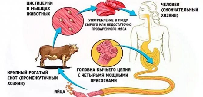 Симптомы цепня у человека. Заражение бычьего цепня. Симптомы заражения бычьего цепня. Цикл развития бычьего цепня промежуточный хозяин. Источник заражения бычьим цепнем.