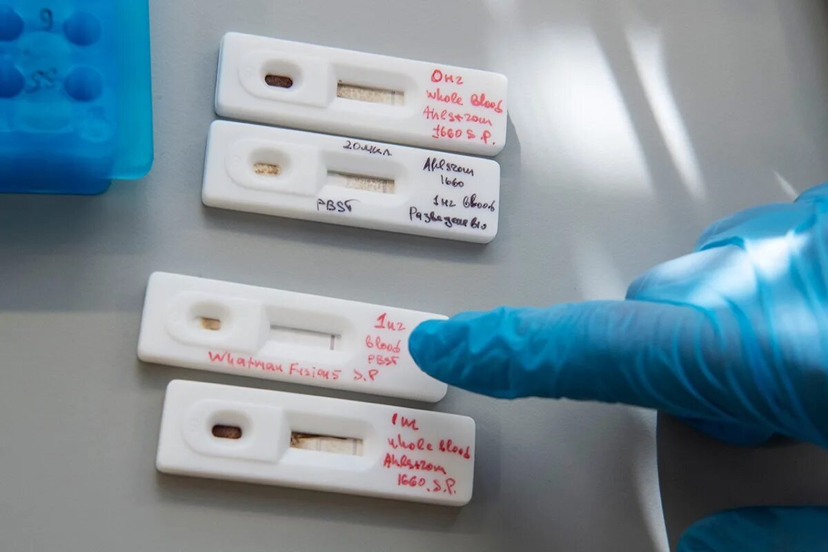 Экспресс тест на антитела к коронавирусу. Как выглядят экспресс тесты. Экспресс-тестирование на covid-19. Экспресс-тест на коронавирус covid-19. Экспресс тест на covid 19 положительный.