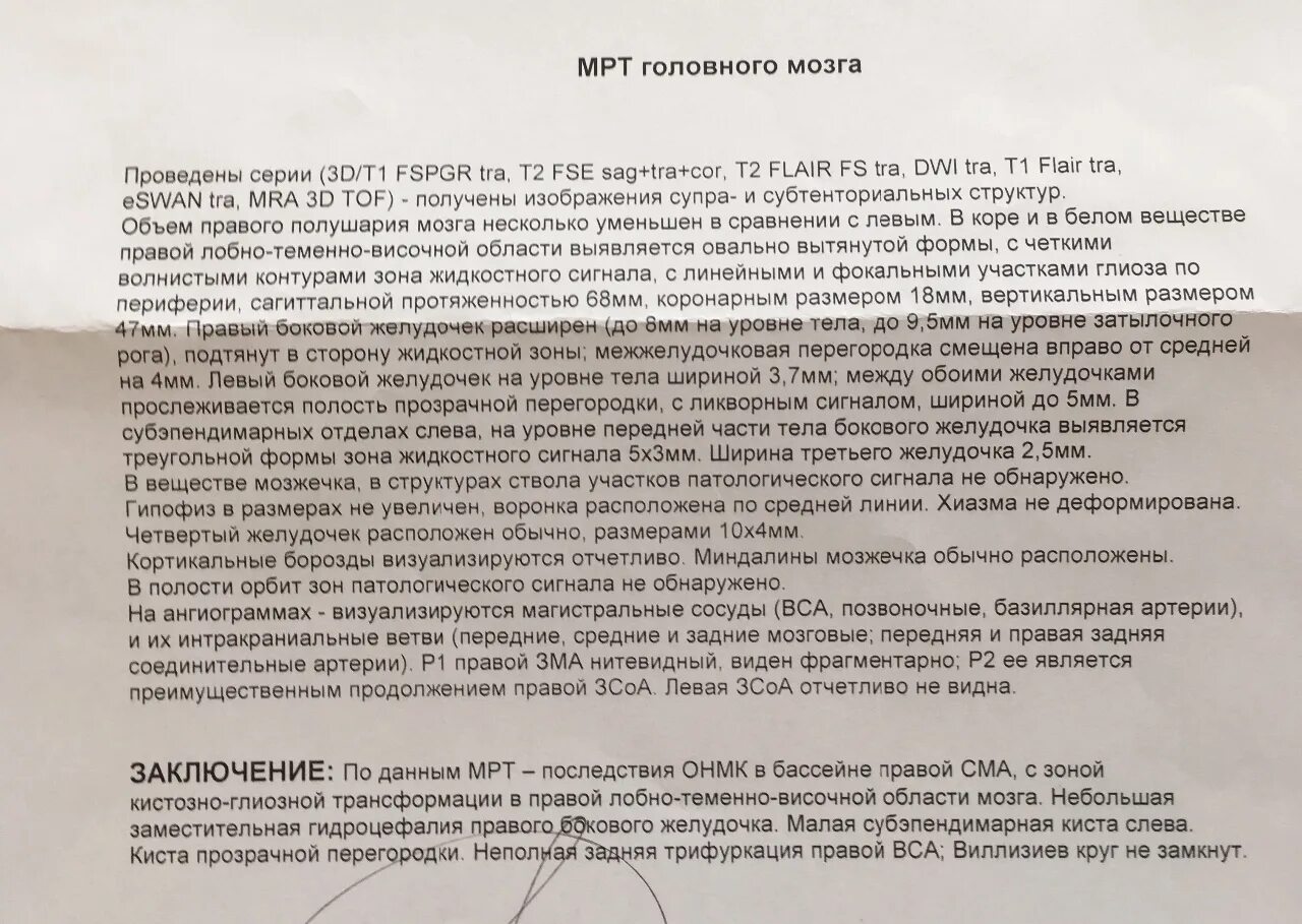 Кистозно глиозные изменения головного мозга что это. Кистозно глиозные изменения головного мозга что это