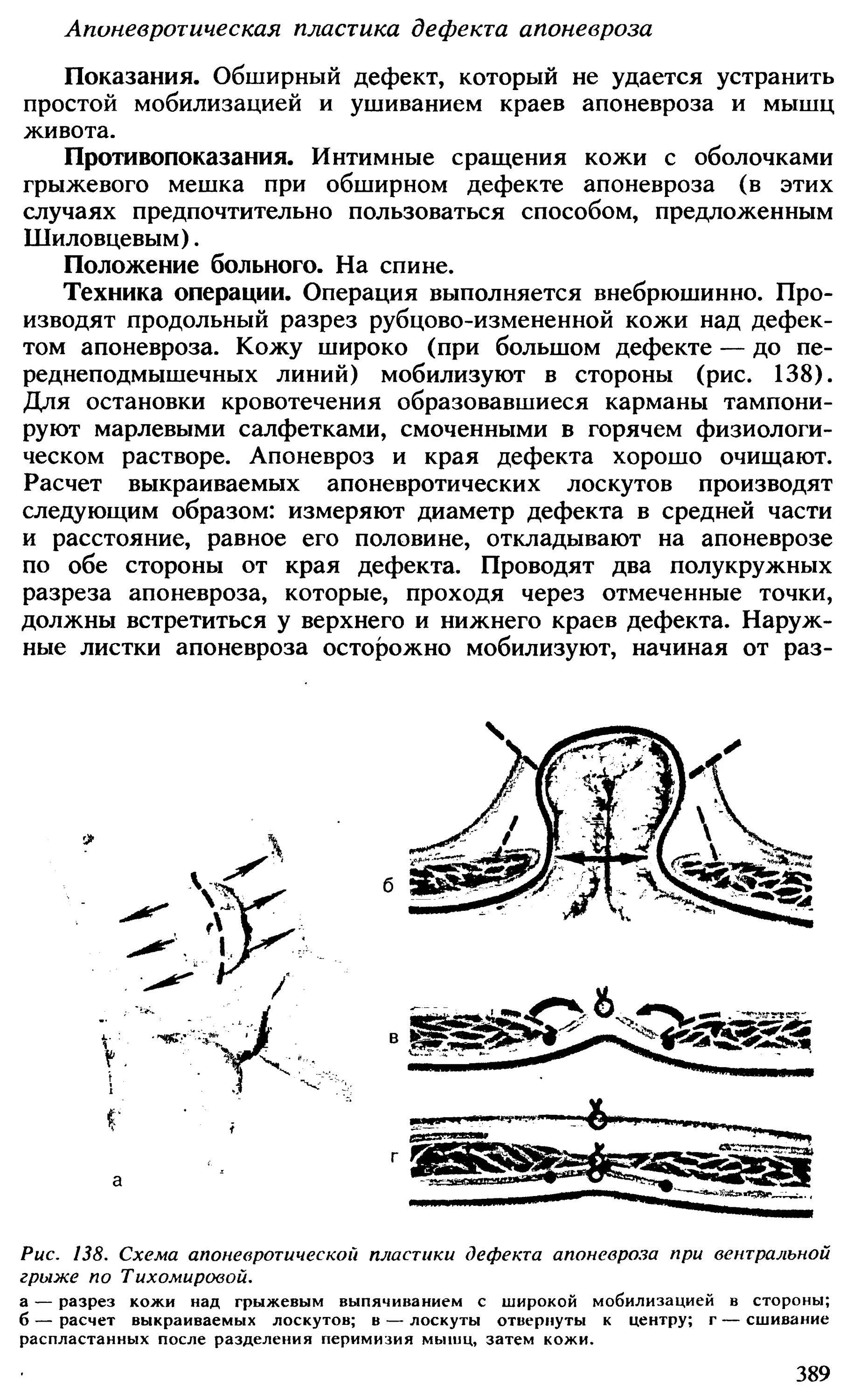 Массаж апоневроза головы