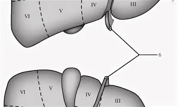 Сегменты печени на УЗИ. Сегменты левой доли печени на УЗИ. 4 Сегмент печени АН УЗИ. 7 Сегмент печени на УЗИ. Узи печени схема