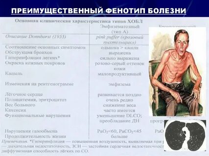 При возрастной эмфиземе у человека