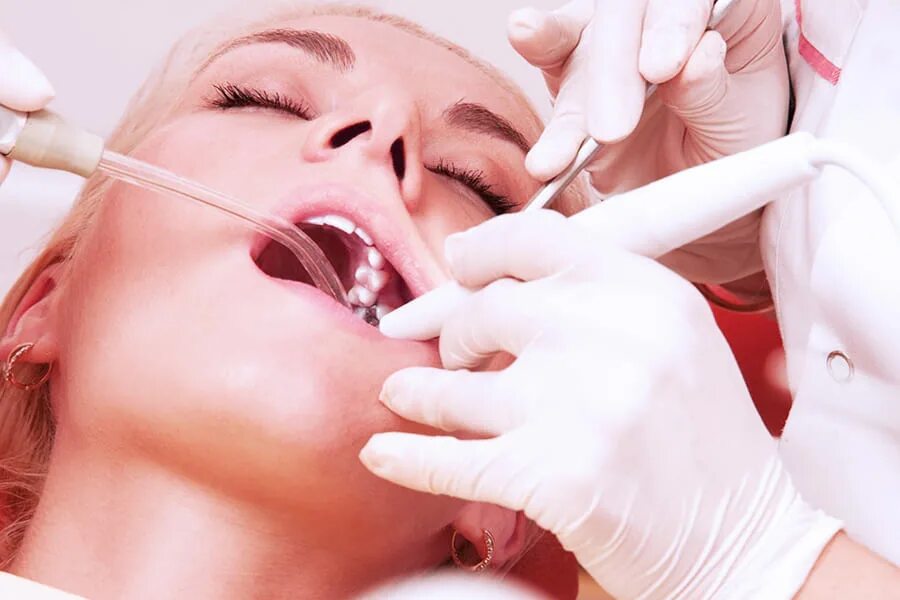 Лечение зуба 8. Лечение зубов верхней челюсти. Стоматологии во Владимире чистка.