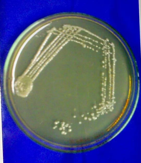 Микобактерии туберкулеза в чашке Петри. Палочка Коха в чашке Петри. Посев (микробиология) колонии. Посев микроорганизмов на питательные среды.