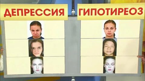 Гипотиреоз загорать