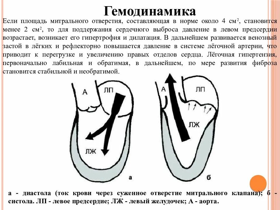 Стеноз митрального клапана нарушение гемодинамики. Митральная недостаточность гемодинамика схема. Нарушения гемодинамики сердца. Схемы изменений гемодинамики при аортальном стенозе. Нарушения гемодинамики сердца.