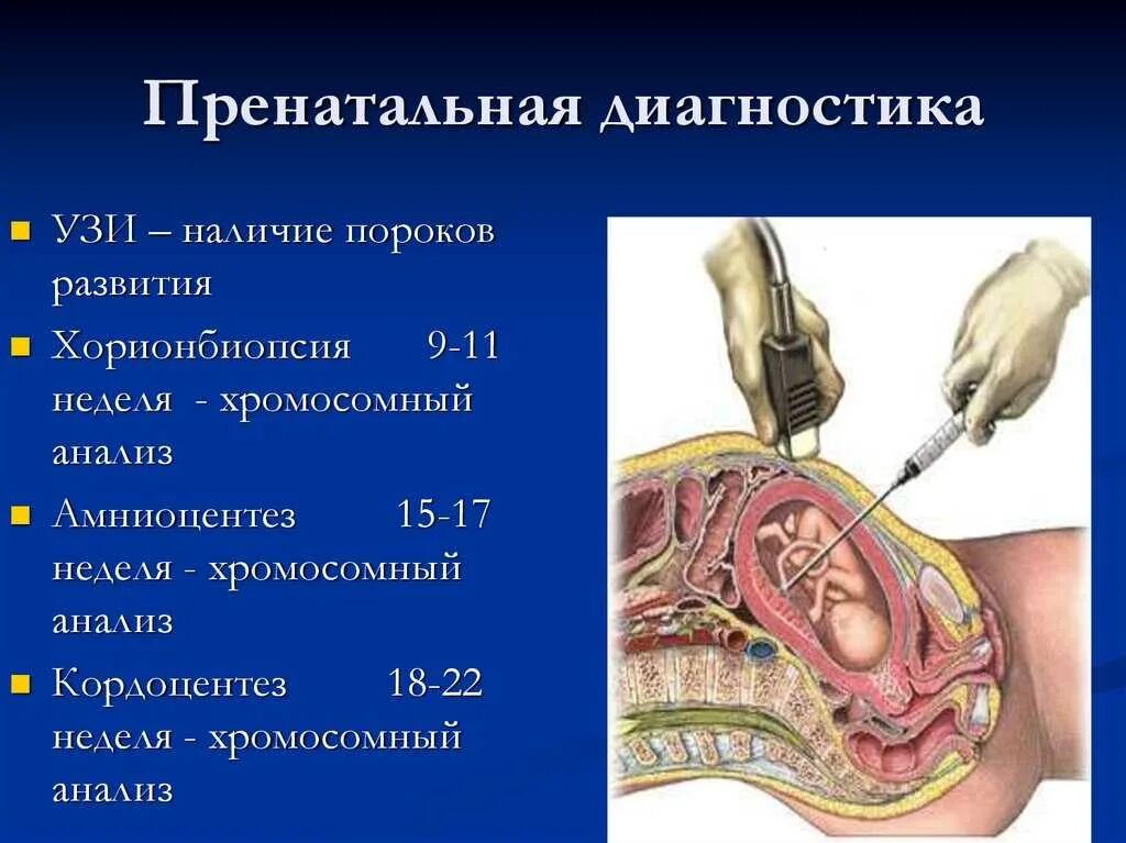 Диагностика развития плода. Биопсия хориона амниоцентез кордоцентез. Трансабдоминальный амниоцентез. Трансабдоминальная биопсия хориона. Методы пренатальной диагностики УЗИ амниоцентез биопсия хориона.