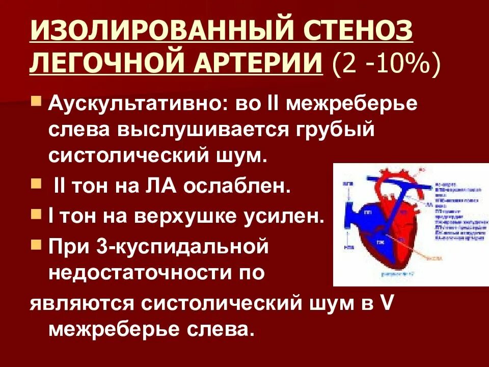 Шум легочной артерии