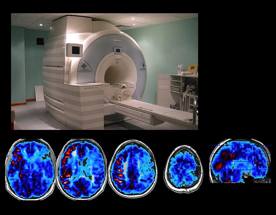 Мрт с седацией. Functional Magnetic Resonance Imaging (FMRI). Функциональная магнитно-резонансная томография (ФМРТ). Мрт и ФМРТ. Мрт с контрастом в Москве.