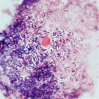 Gardnerella vaginalis причины возникновения