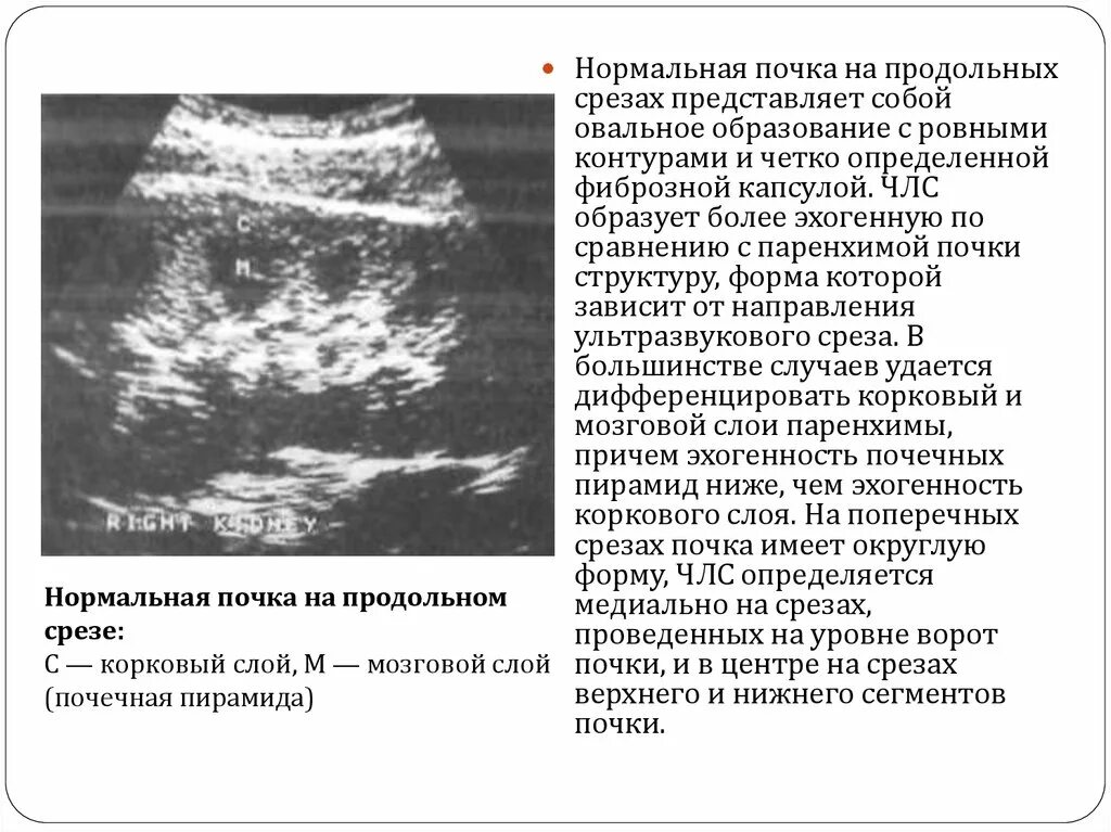 Изменение левой почки. Что такое ЧЛС почек на УЗИ. Диффузное уплотнение ЧЛС почек УЗИ. Синдром гиперэхогенных пирамид почек УЗИ. Уплотнение паренхимы почки УЗИ.