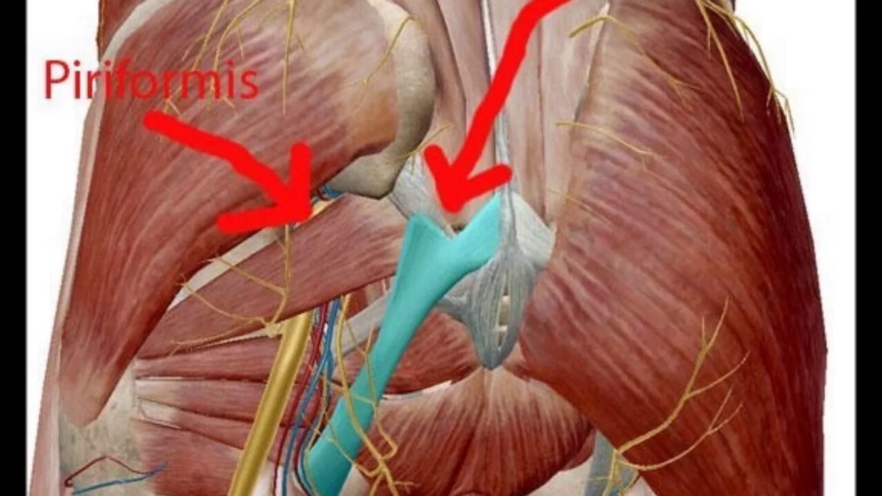 Мышца седалищного нерва. Бедренный нерв и седалищный нерв. Защемление седалищного мышцы. Защемление nervus femoralis. Ягодичные мышцы, седалищный нерв анатомия.