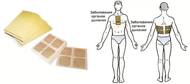 Горчичники как пользоваться. Куда ставить горчичники при кашле. Схема постановки горчичников при бронхите. Схема постановки горчичников при кашле у ребенка. Перцовый горчичники при кашле.