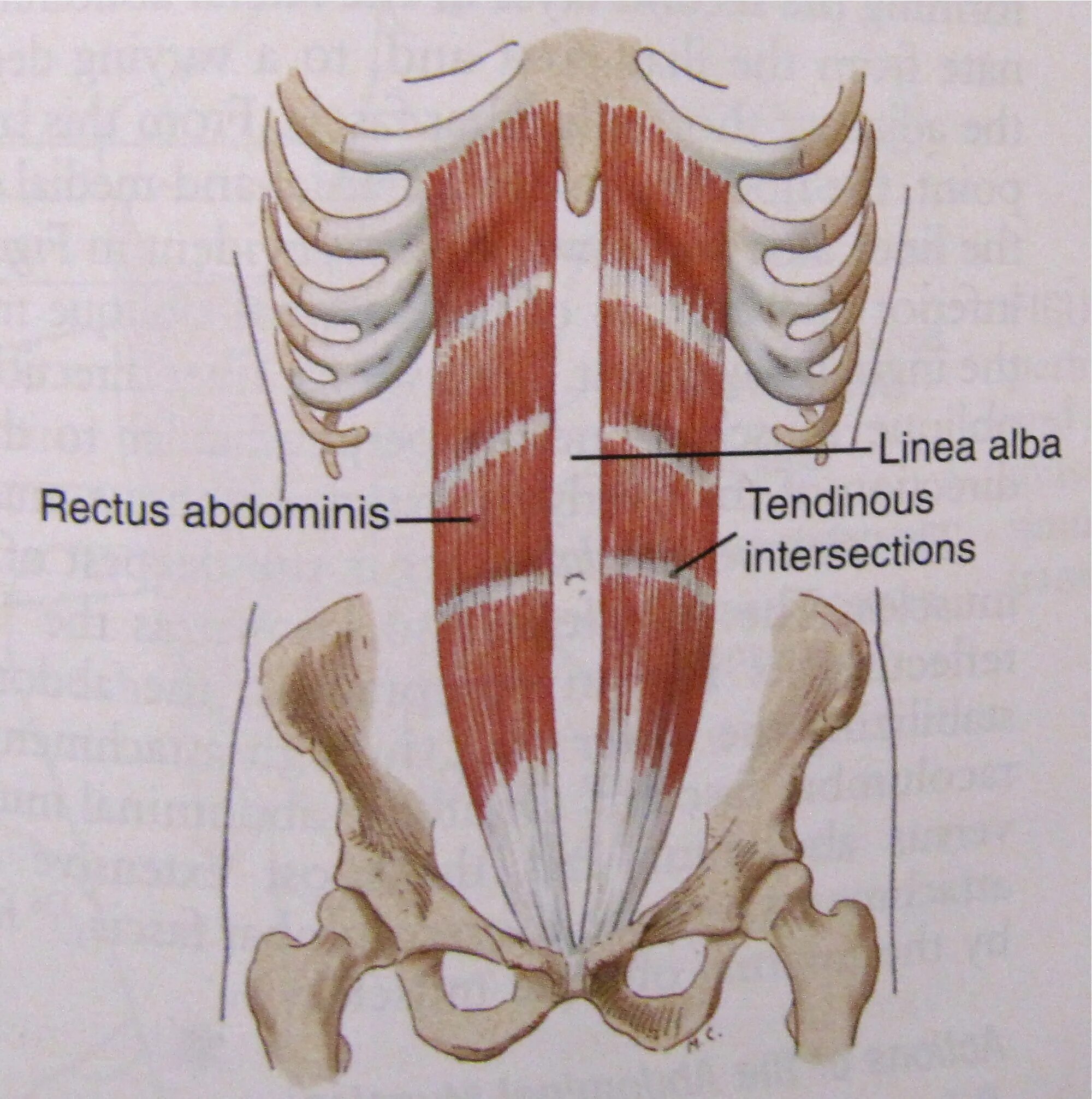 Rectus abdominis мышца. Transversus abdominis. Obliquus externus abdominis. Transversus abdominis мышца.