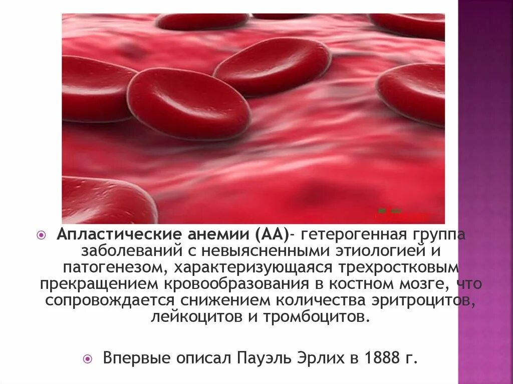 Анемия крови что это. Апластические анемии костный мозг. Рефрактерная и апластическая анемия. Апластическая анемия патанатомия. Апластическая анемия кровь.