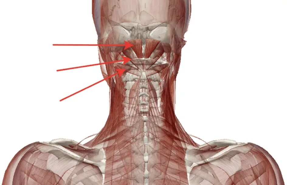 Болит голова и мышцы шеи. Мышцы шейного отдела.