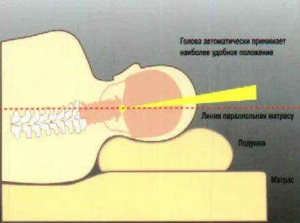Как спать правильно при остеохондрозе шейного отдела