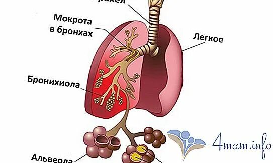 Выводит мокроту из бронхов у детей. Вывод мокроты из бронхов и легких. Выведение мокроты из легких.