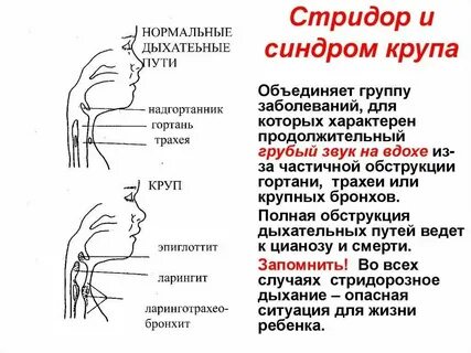 Удлиненный свистящий выдох