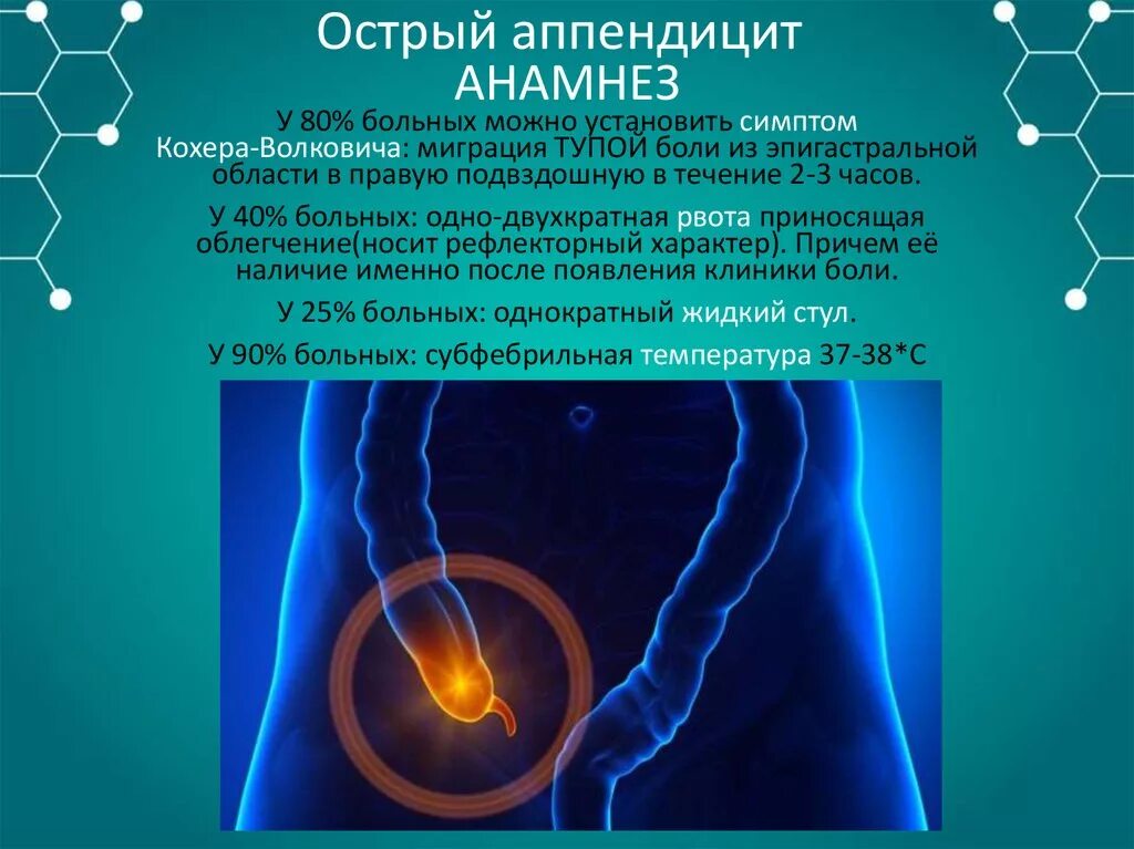 Статистика аппендицита. Мкб 10 острая боль в животе. Анамнез аппендицита.