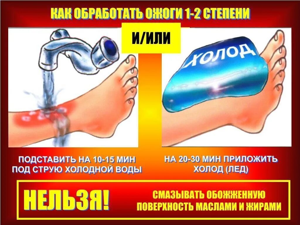 Что приложить к ожогу