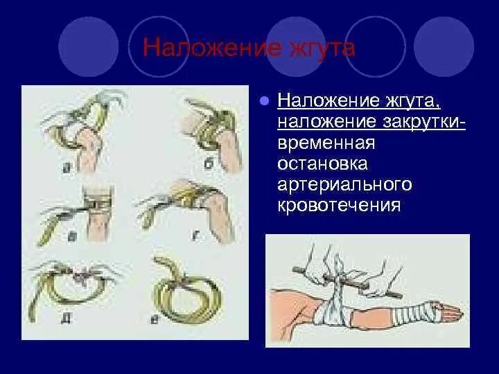 Алгоритм наложения жгута при артериальном кровотечении. Наложение жгута закрутки. Алгоритм наложения закрутки. Наложение жгута при артериальном кровотечении. Алгоритм наложения жгута.