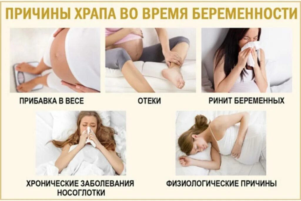 Сильный храп во сне. Храп у беременных женщин. храп у женщин при беременности. причины храпа у беременных женщин.
