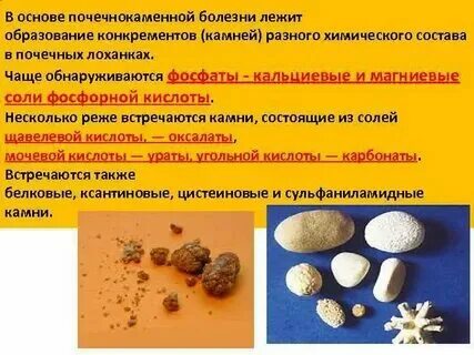 Химический состав конкремента