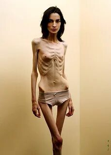 Anorexic sex thread. 