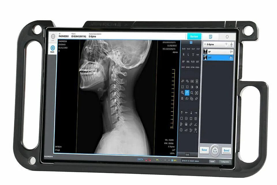 X-ray vsp150ndt. Х-ray scan v3.0. Diagnostic x-ray Equipment ray98. Балзер модуль XR X ray. Xray extension