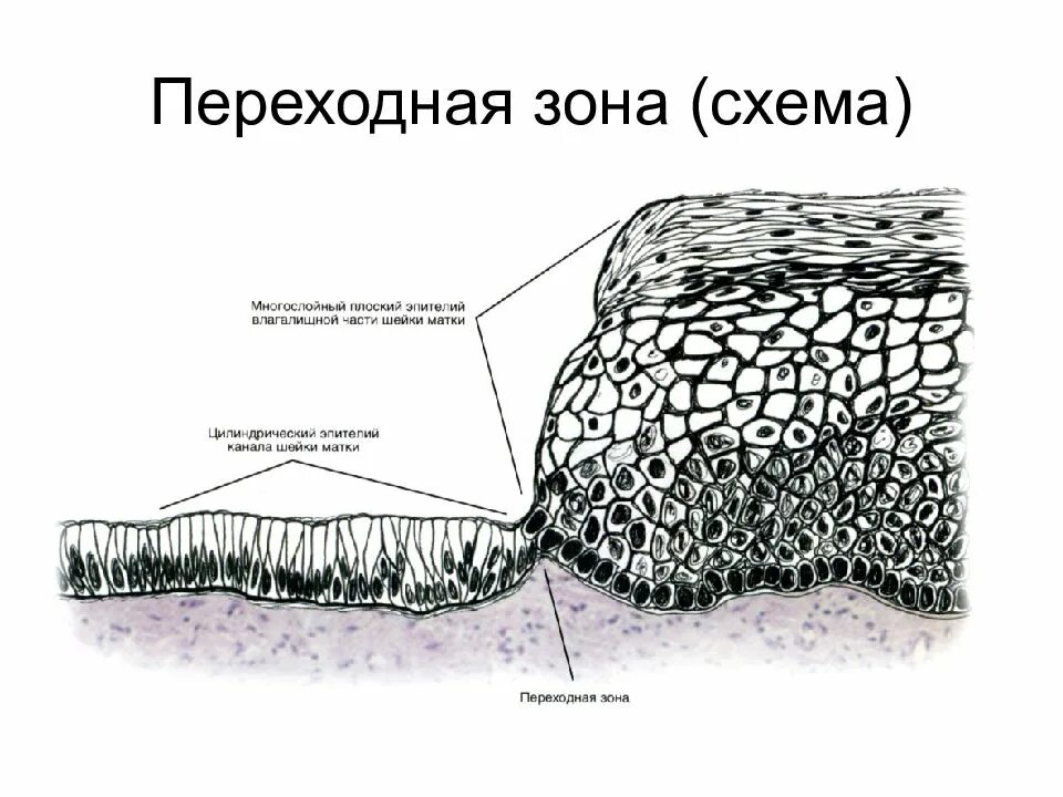 Изменения эпителия матки. Переходная зона шейки матки гистология. Многослойный плоский эпителий шейки матки гистология. Строение стенки шейки матки. Цервикальный эпителий гистология.