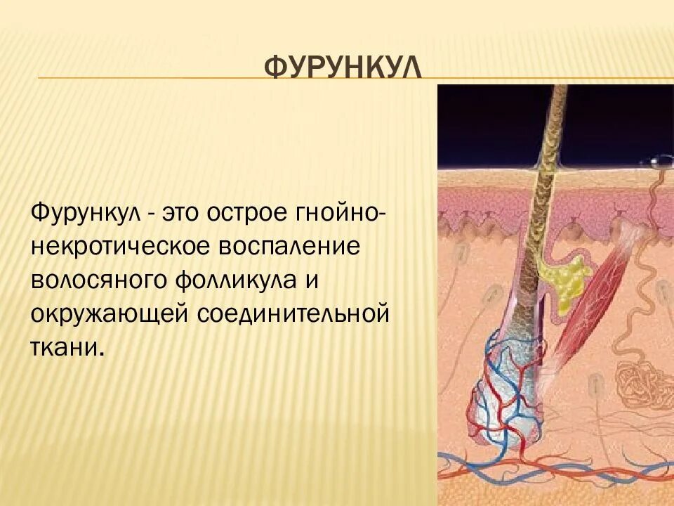 Что такое и от