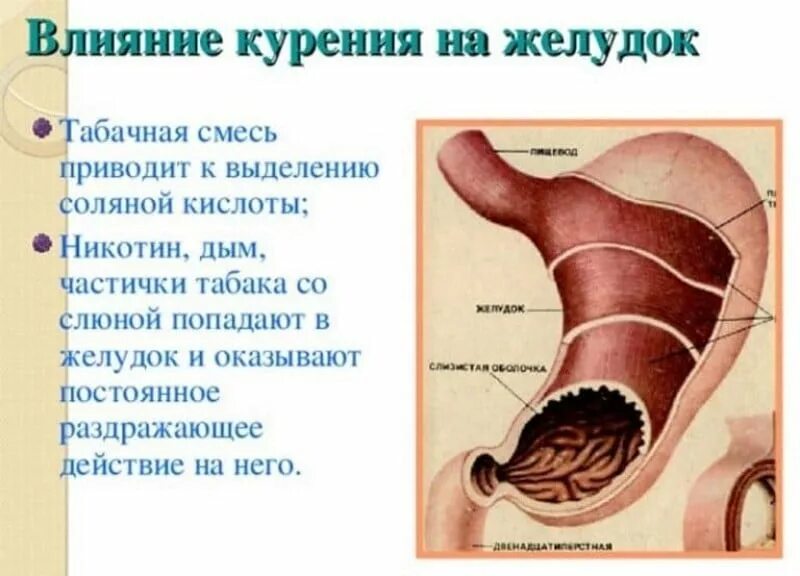 курение при гастрите