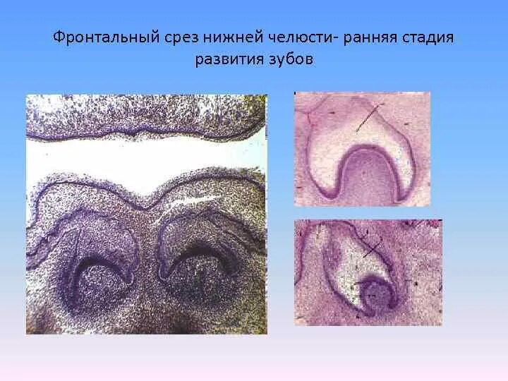 Стадии развития зуба. Ранняя стадия развития зуба гистология. Поздняя стадия развития зуба гистология препарат. Ранняя стадия развития зуба гистология препарат. Стадии развития зуба гистология.