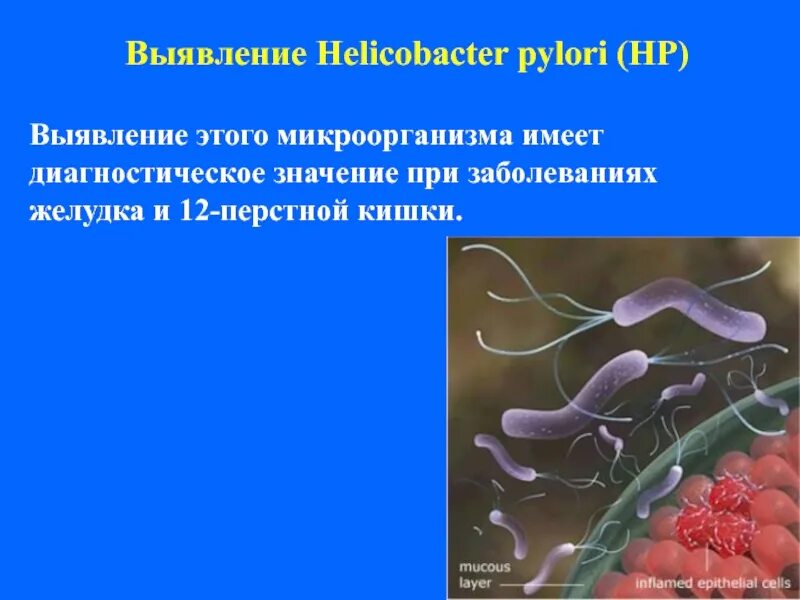 Пути передачи хеликобактер. Антигенная структура хеликобактер пилори. бактерия хеликобактер пилори схема. хеликобактер пилори систематика.