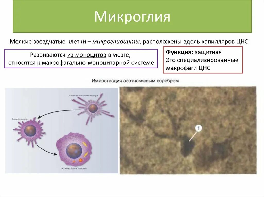 Клетки микроглии. Микроглия клетки гистология. клетки микроглии строение. функции микроглии. структура микроглии.