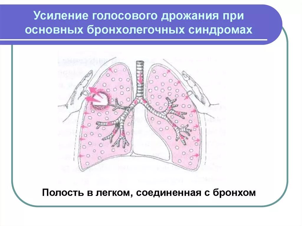 Усиленное голосовое дрожание. Механизмы усиления голосового дрожания. Усиление голосового дрожания при. Осилини галосовая дражания. Причины изменения голосового дрожания.