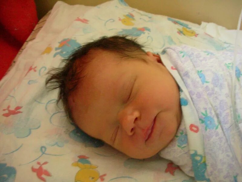 Кривошея у новорожденных. Кривошея у новорожденных признаки. Кривошея в 3 месяца. Кривошея у грудничка 5 месяцев симптомы. Кривошее у новорожденных.