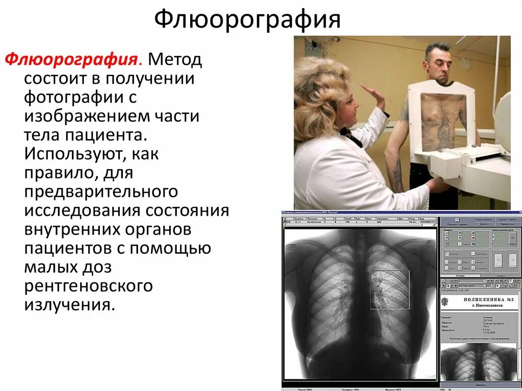 Сколько раз делают флюорографию в год взрослым. Флюорография. Флюорография методика. Флюорография метод исследования. Флюорографическое обследование грудной клетки.