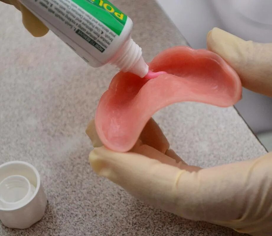 Чем можно приклеить зуб. Стоматологический клей для протезов. Клиническая перебазировка протезов. Клей для фиксации зубных протезов. Клей для склейки зубных протезов.