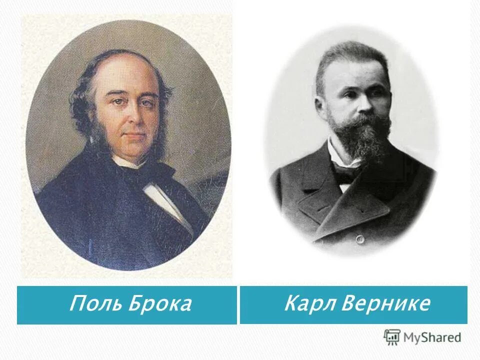 Поль Пьер Брока. Поль Брока 1824-1880. Поль Брока французский хирург. Поль брока