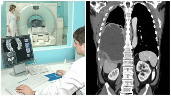 РКТ позвоночника. Компьютерная томография позвоночника. Спиральная компьютерная томография спины. Можно делать кт позвоночника